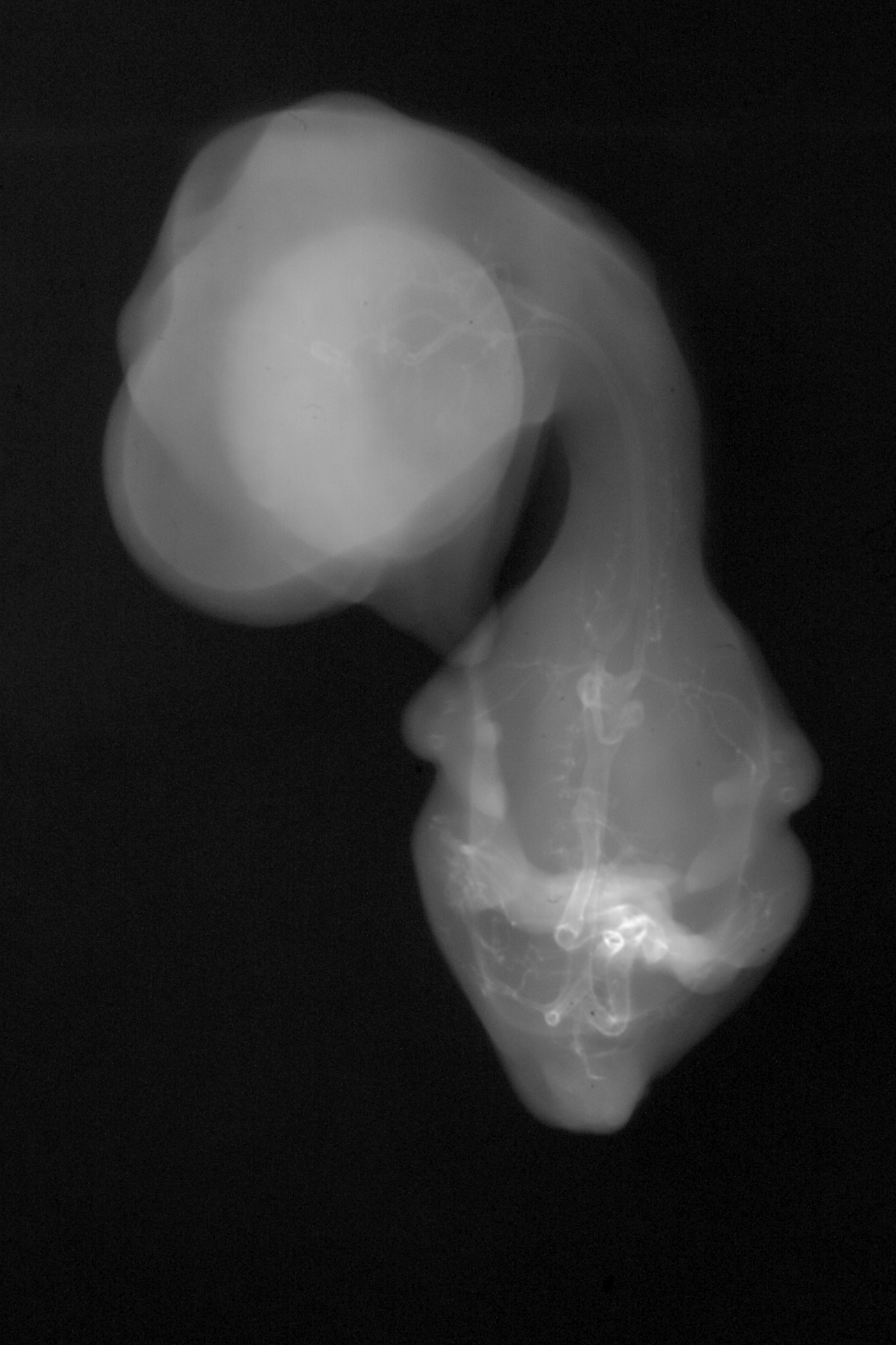 stage 35 chick embryo x-ray